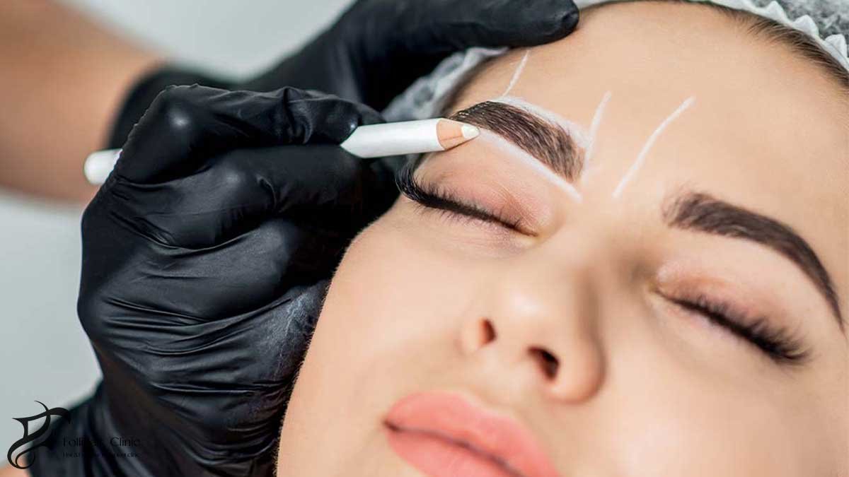 Detail Level on Eyebrow Transplant Cost