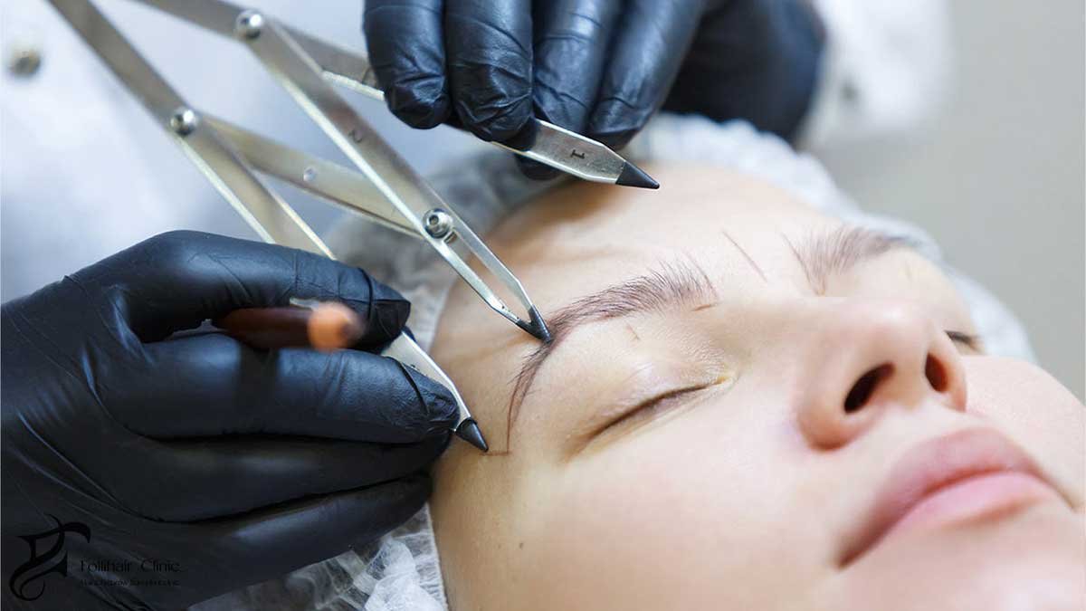 Eyebrow Transplant Process