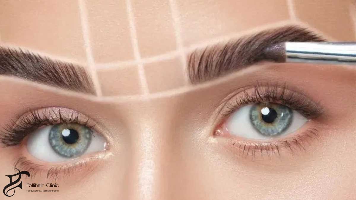 Understanding the Eyebrow Transplant Process