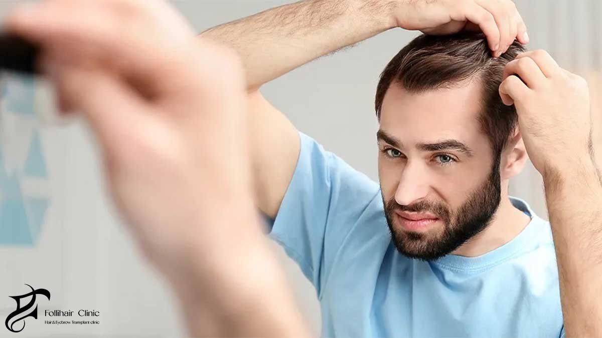 Capillary Treatment v Hair Transplant
