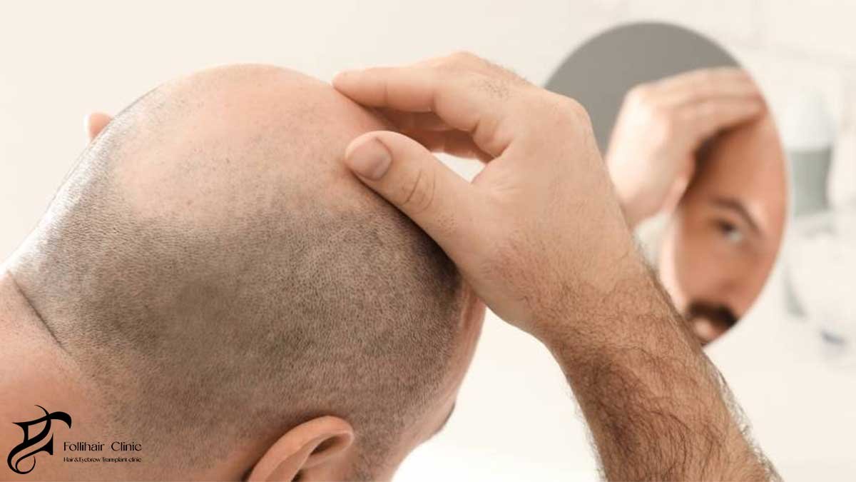 Failure to Attend Follow-Up Assessments