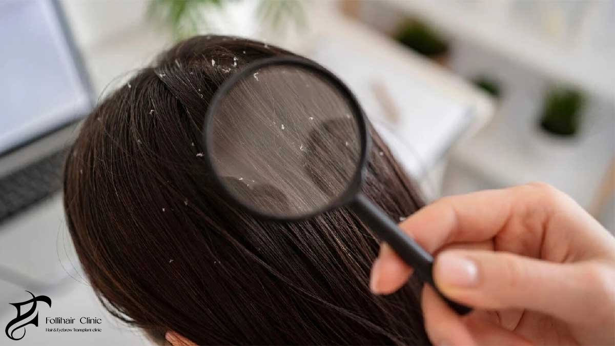 restore scalp health