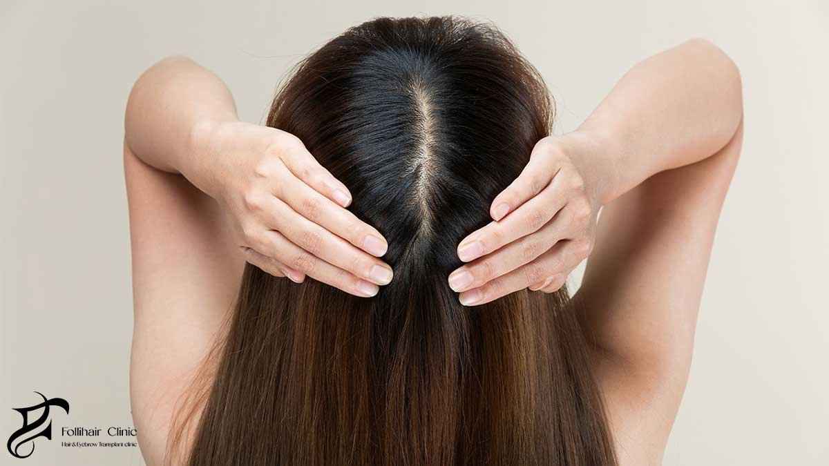 Lifestyle Adjustments That Support Scalp Recovery