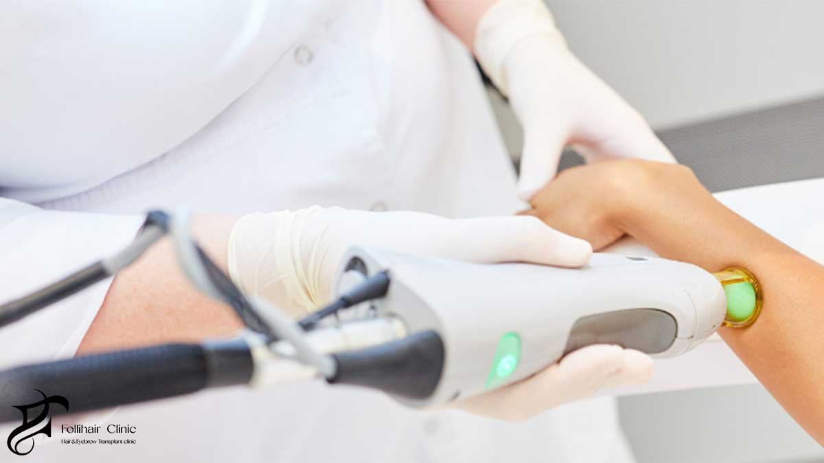 Skin Recovery and the Importance of Adequate Spacing