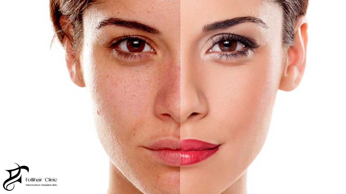 Supporting Skin Repair Beyond Sunscreen