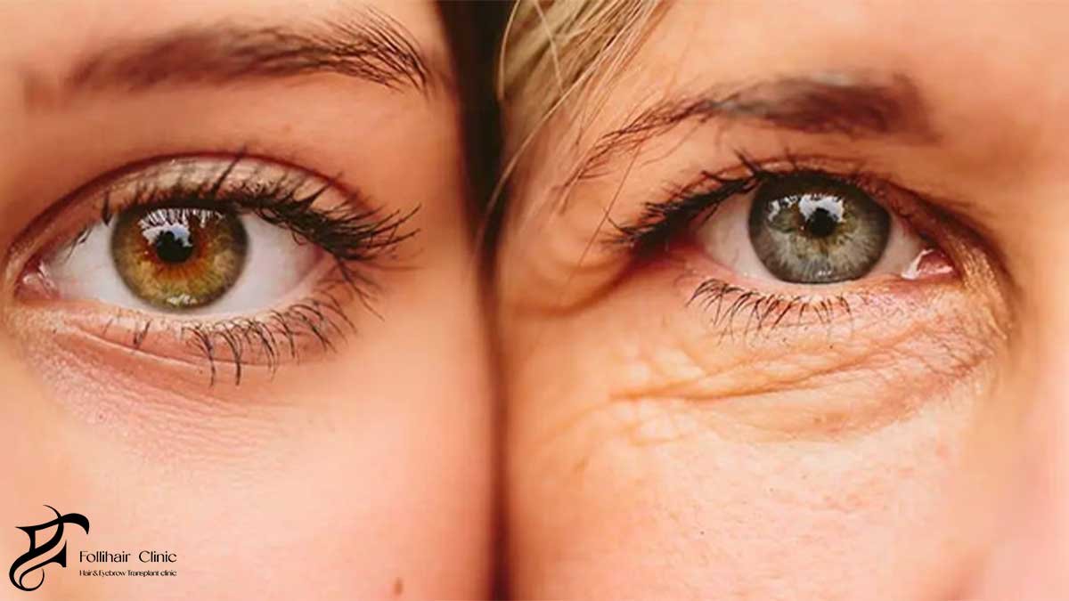 alcohol and fast food effects on skin and hair