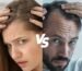 hair loss differences between men and women